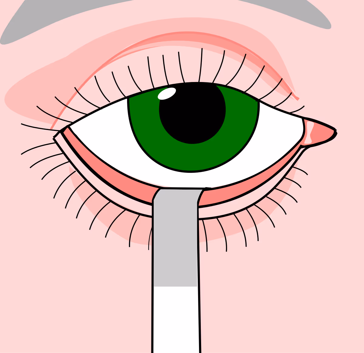 Teste de Schirmer: avalia a produção aquosa do filme lacrimal.