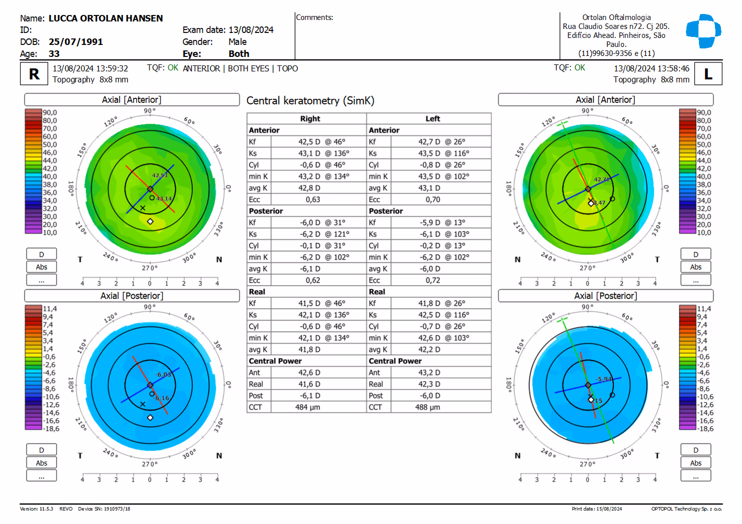 Imagem da página /exames/oct-de-cornea