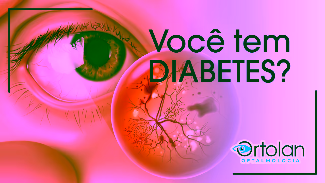 Você tem Diabetes? Sabia que Precisa de Exame Anual da Retina?