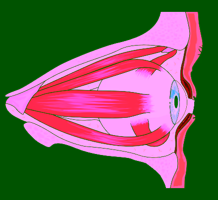 Diplopia (Visão Dupla)
